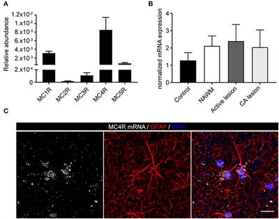 Setmelanotide, a Novel, Selective Melanocortin Receptor-4 Agonist Exerts Anti-inflammatory Actions in Astrocytes and Promotes an Anti-inflammatory Macrophage Phenotype